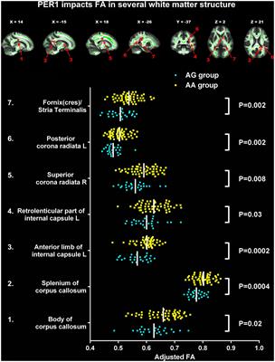 Per1 gene polymorphisms influence the relationship between brain white matter microstructure and depression risk